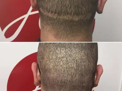 tête