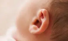 eczema de l'oreille