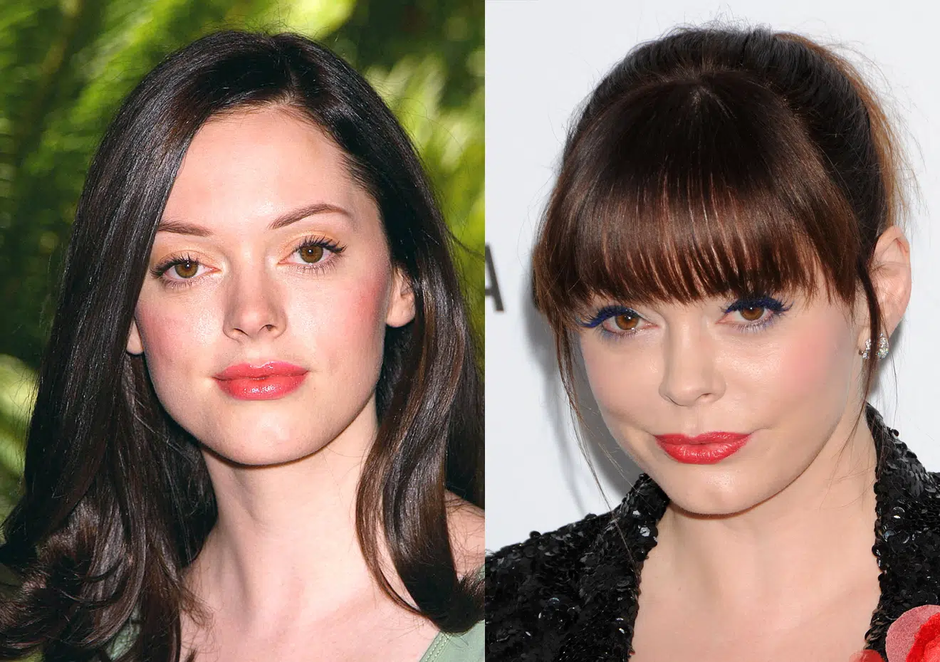Quand faire recours à la chirurgie du visage
