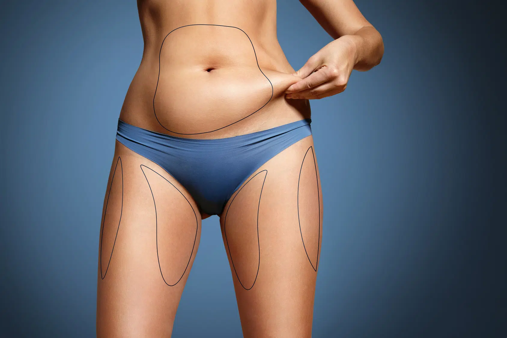 chirurgie esthétique la liposuccion
